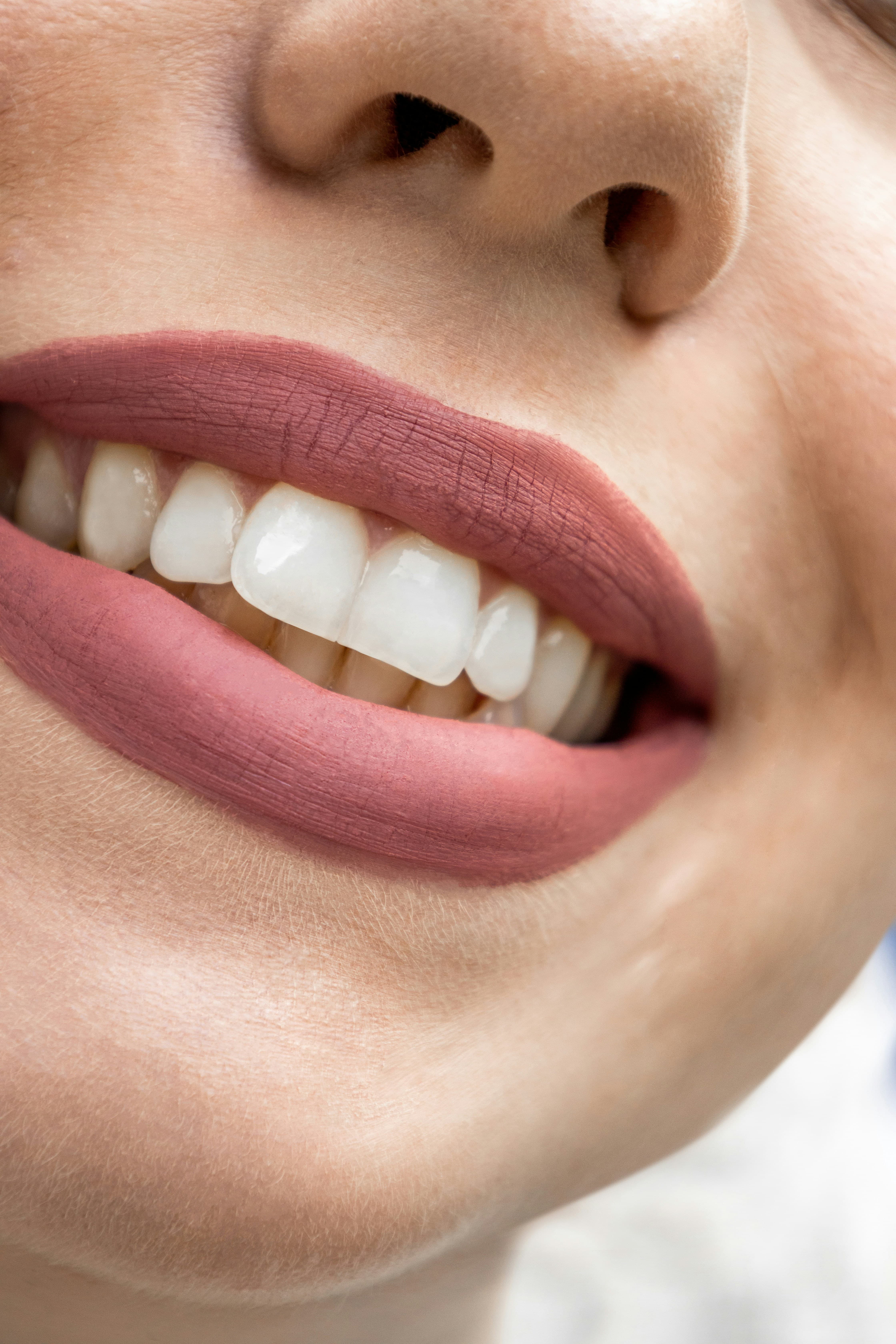 Composite bonding result